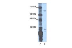 ZNF691 Rabbit anti-Human, Polyclonal, Novus Biologicals 0.1 mL | Buy Online | Novus Biologicals | Fisher Scientific
